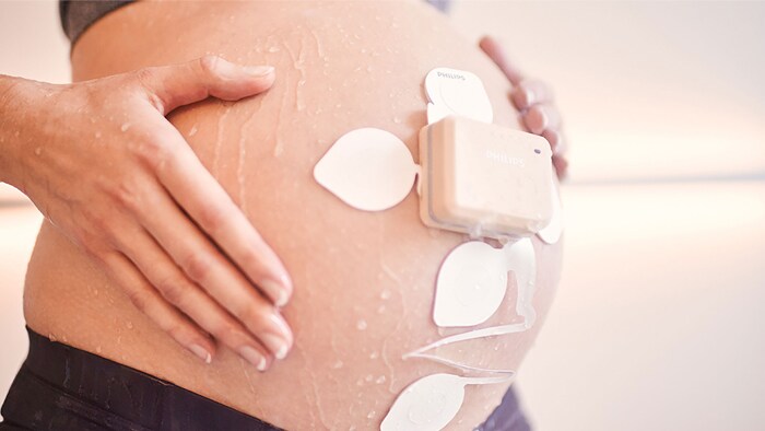 Philips lanceert oplossing om de monitoring van zwangere vrouwen te ondersteunen