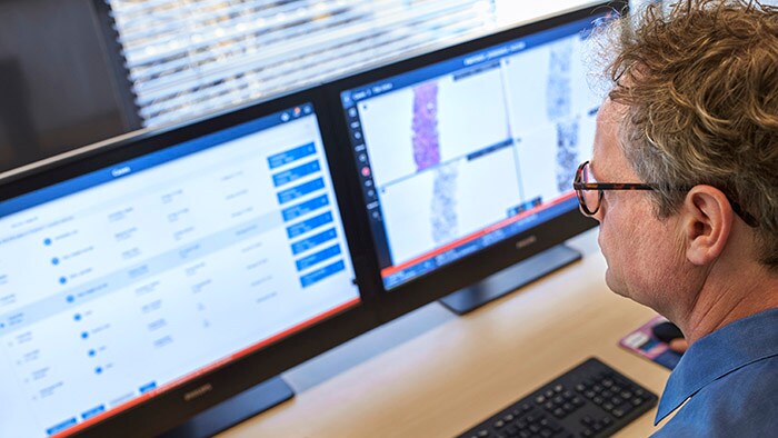 Philips introduceert de volgende generatie Digital Pathology Suite