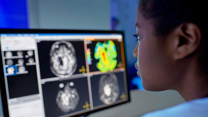Philips zet nieuwe oplossingen voor de verbetering van workflowoptimalisatie en precisie diagnose in de schijnwerpers tijdens ECR 2021