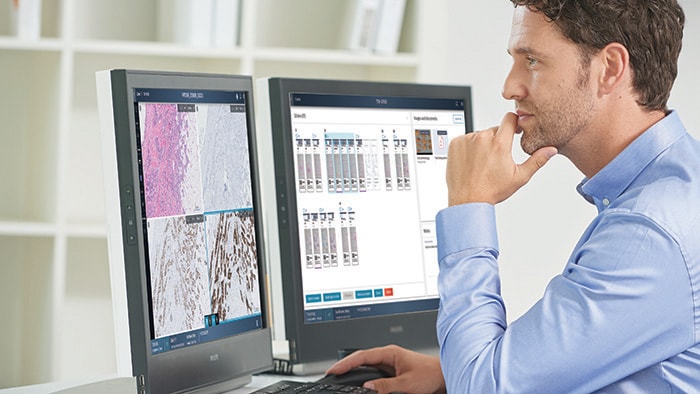 Philips en Ibex Medical Analytics werken samen om de invoering van AI in digitale pathologie te versnellen
