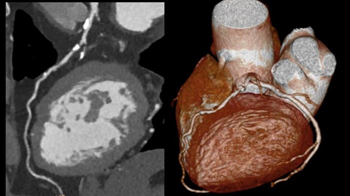 Download image (.jpg) Precise Suite Incisive cardiac (opent in een nieuw tabblad)