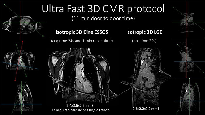 Ultra fast 3C CMR protocoll (opent in een nieuw tabblad)