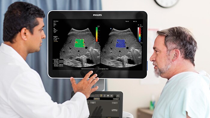 Philips breidt echografieportfolio uit om het diagnostische vertrouwen en de workflowefficiëntie te vergroten
