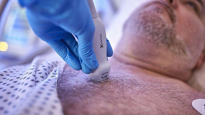 Philips introduceert nieuwe echocardiografie innovaties waarin nieuwe transducertechnologie, AI-gestuurde geautomatiseerde metingen en toegang op afstand zijn samengebracht