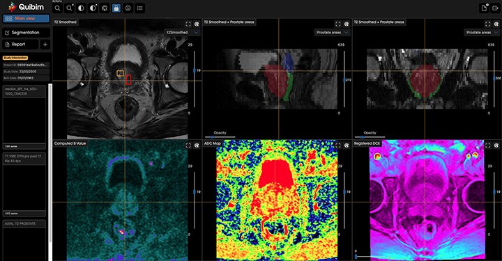 Quibim platform qp prostate user interface