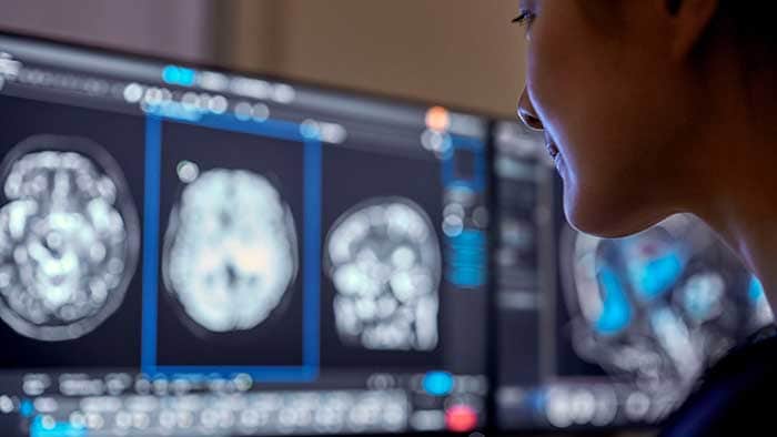 Philips lanceert nieuwe innovaties met AI tijdens #RSNA23 om zorgverleners de ruimte te geven zich op patiëntenzorg te richten