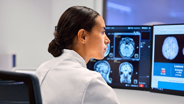MR-technoloog beoordeelt neurobeelden in de icometrix AI-rapportagetool -  