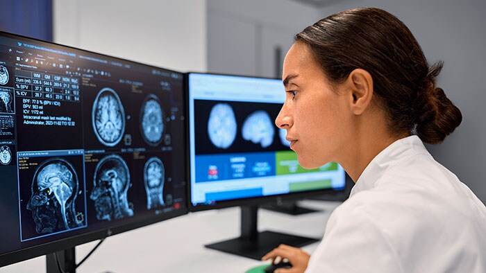 Philips en icometrix verbeteren precisiediagnostiek in neurologie met innovatieve, op AI gebaseerde beeldvormingsoplossingen op #RSNA24