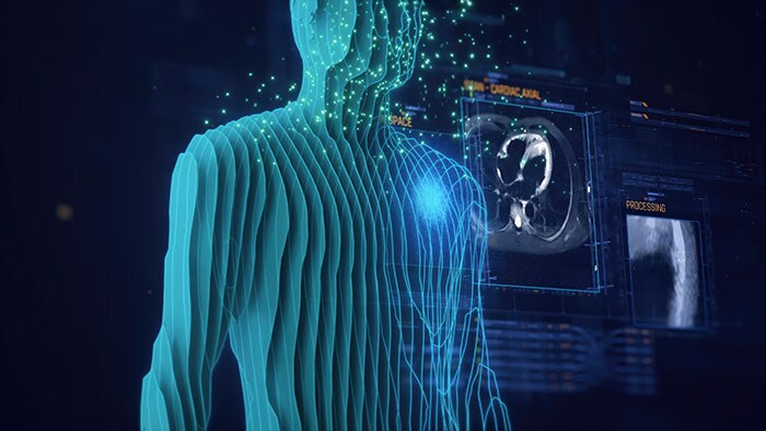 Philips wil cardiale MRI-technologie verbeteren met AI-gestuurd onderzoek