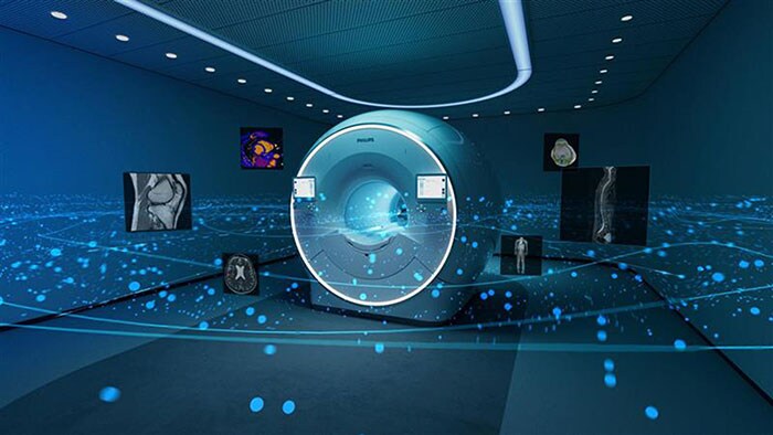 Philips op #ECR2025: Nieuwe op AI gebaseerde systemen, intelligente software en cloudservices voor beeldvorming stroomlijnen radiologieworkflows en nieuwe klinische inzichten
