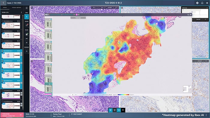 PIPS 6.0 with Ibex AI -  
