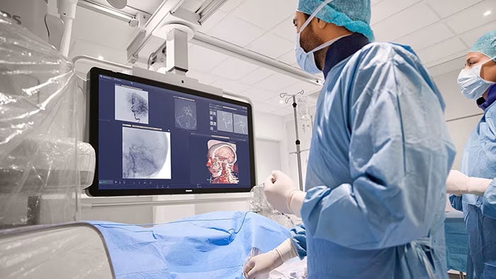 AI-enabled cardiovascular ultrasound platform -  