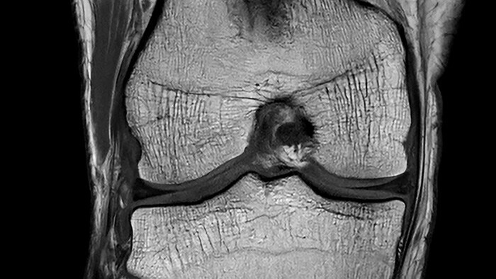 Philips versnelt nauwkeurige beeldvorming met unieke AI-technologieën bij MRI om patiëntresultaten te verbeteren