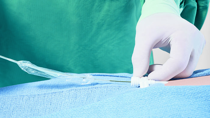 The Philips Bridge Plus Balloon, uninflated prior to use -  