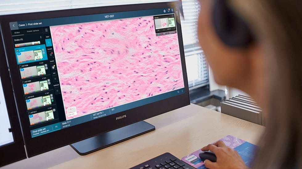 Clinician reviewing digital pathology slide