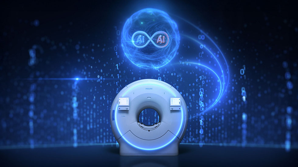 Dual AI engines in SmartSpeed Precise