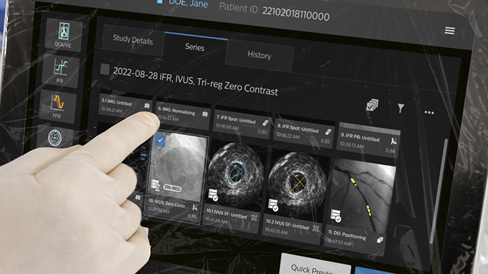Philips IntraSight Plus