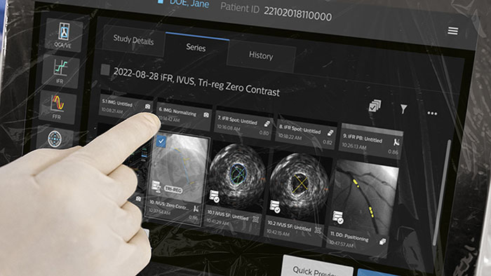 Philips IntraSight Plus -  