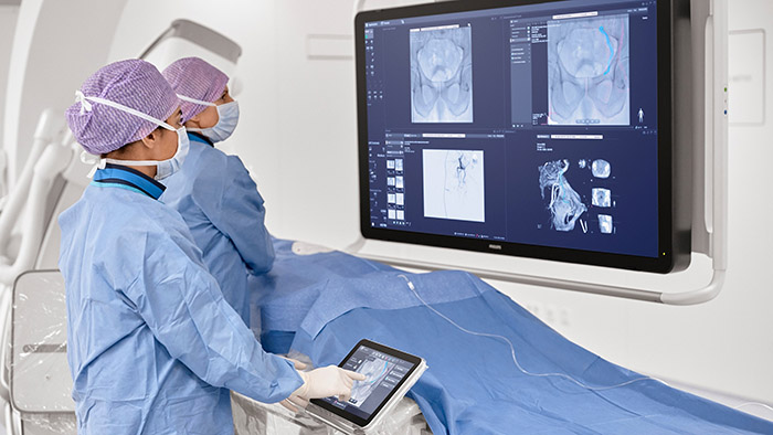 Philips Azurion interventional oncology procedure -  