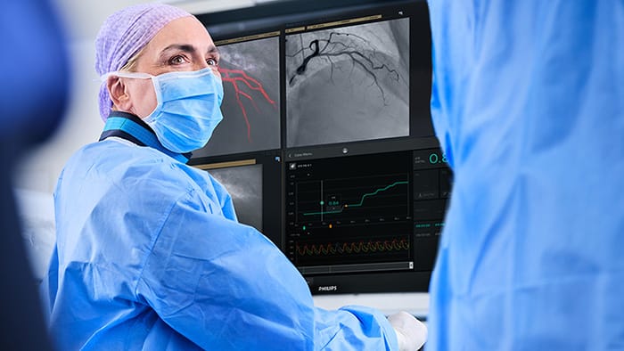 Philips introduceert SmartIQ om de balans tussen beeldkwaliteit en stralingsdosis bij coronaire procedures te optimaliseren