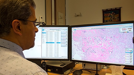 Analysis of digital scan of glass tissue sample (opent in een nieuw tabblad)