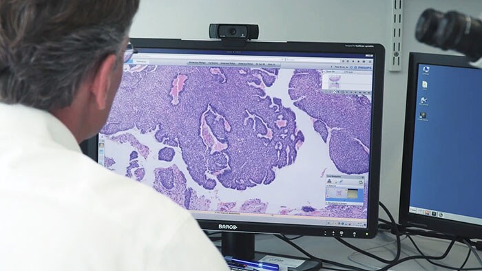 Philips en Pathologie DNA ondertekenen raamovereenkomst digitale pathologie (opent in een nieuw tabblad)