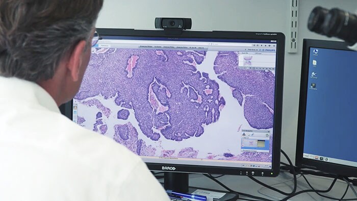Philips en Pathologie-DNA sluiten raamovereenkomst over digitale pathologie