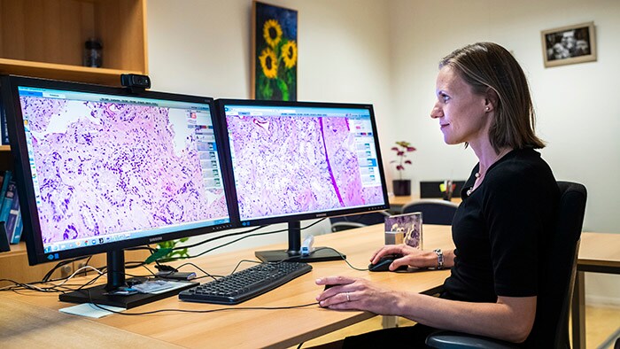 De microscoop verdwijnt uit de kamer van de patholoog