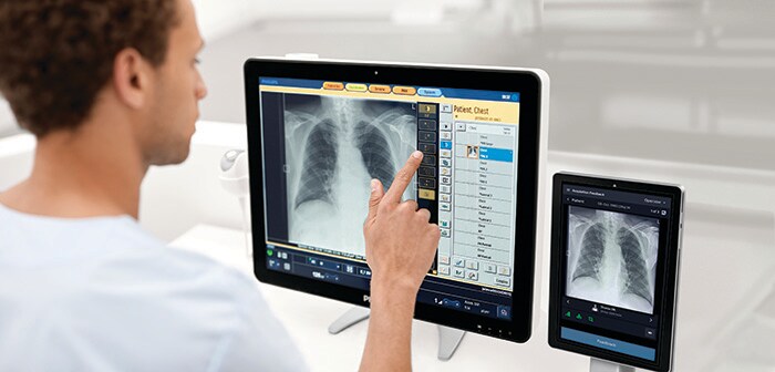 Radiology Smart Assistant (opent in een nieuw tabblad)