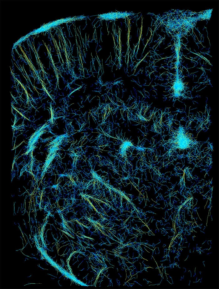 Een conventioneel ULM Super Resolution Ultrasound van een rattenbrein