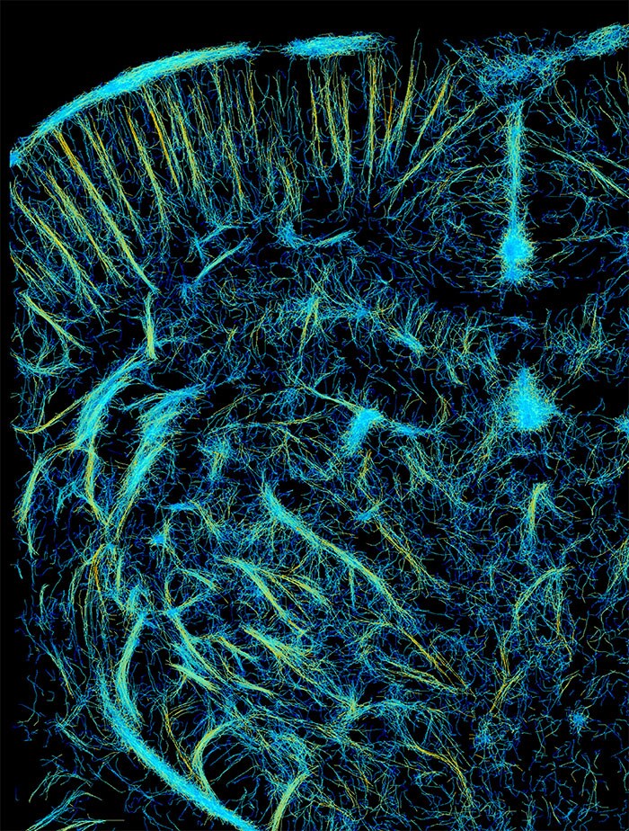 Het verbeterde Super-Resolution beeld van het e/MTIC team 