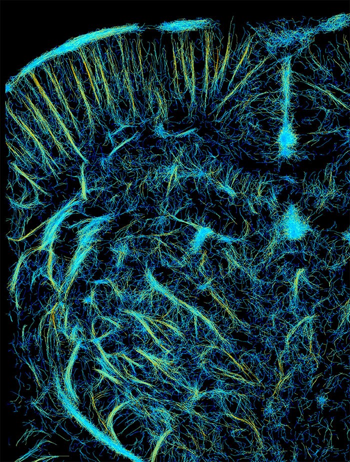 Het verbeterde Super-Resolution beeld van het e/MTIC team 