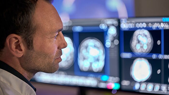 Telegraaf: Philips zet vol in op AI voor toepassingen in de gezondheidszorg