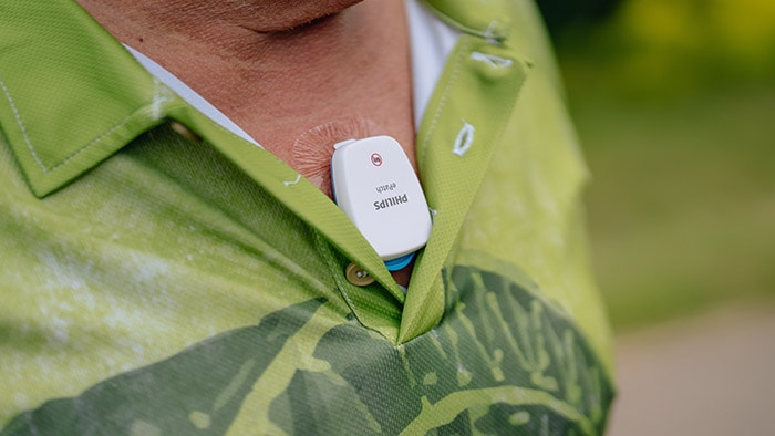 Philips ePatch -  