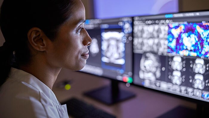 BNR Beter: 7 Tesla MRI scanner door Amsterdam UMC ingezet voor patiëntenzorg