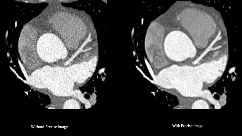 CT 5300 cardiac clinicial image