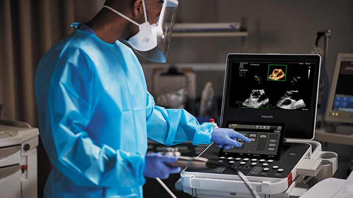 Philips Compact Ultrasound 5500CV -  