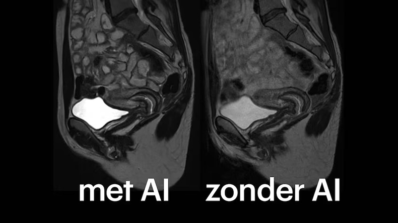 Scan met en zonder AI
